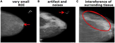 MNet-10: A robust shallow convolutional neural network model performing ablation study on medical images assessing the effectiveness of applying optimal data augmentation technique